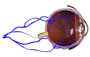 Vein Occlusion